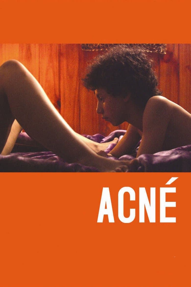 Acne (2008) WEBRip 480p | 720p | 1080p Movie Download